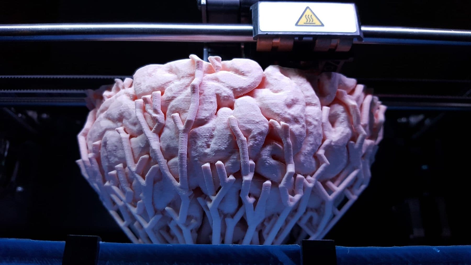 3D printed brain model standing on tree-like support structures